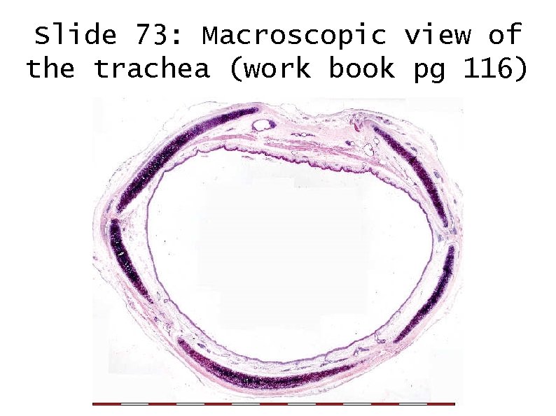Slide 73: Macroscopic view of the trachea (work book pg 116) 