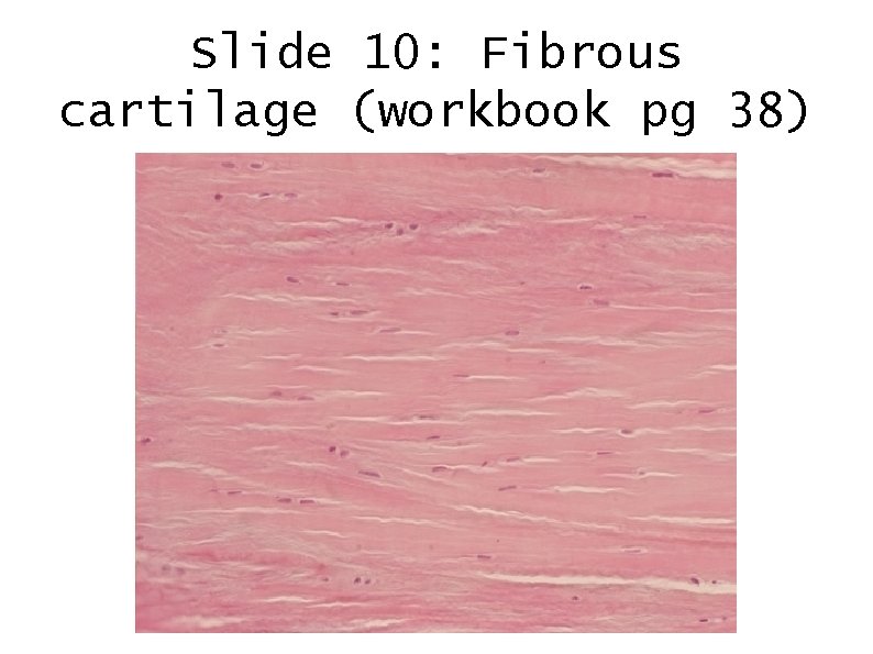 Slide 10: Fibrous cartilage (workbook pg 38) 