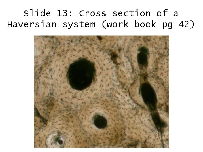 Slide 13: Cross section of a Haversian system (work book pg 42) 