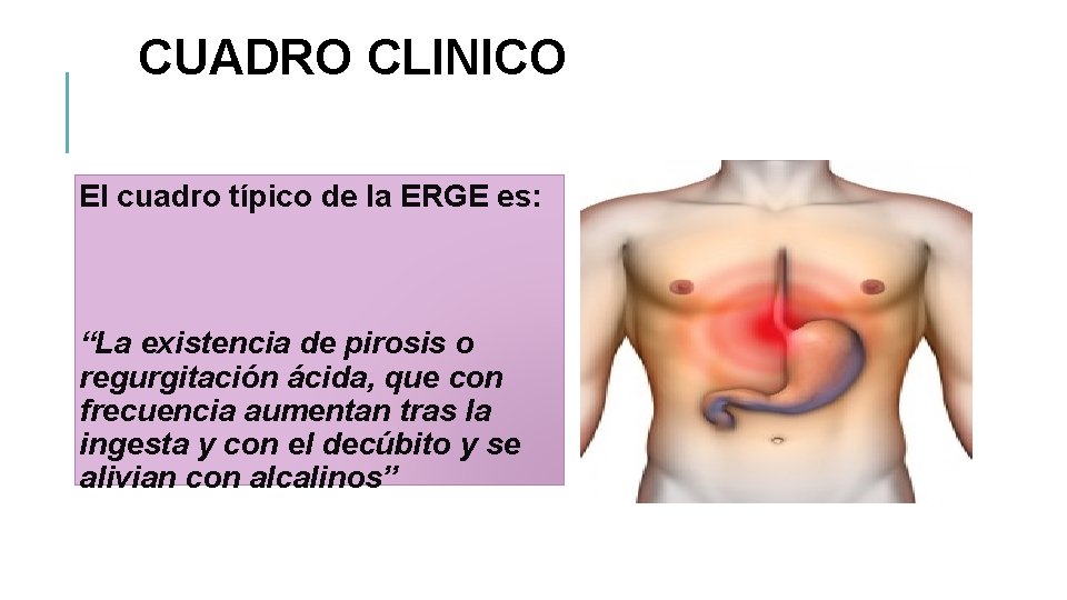 CUADRO CLINICO El cuadro típico de la ERGE es: “La existencia de pirosis o