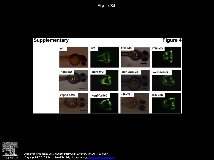 Figure S 4 Kidney International 2017 92836 -849 DOI: (10. 1016/j. kint. 2017. 03.