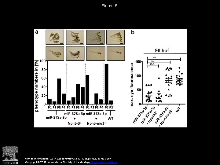 Figure 5 Kidney International 2017 92836 -849 DOI: (10. 1016/j. kint. 2017. 03. 005)