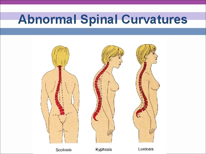 Abnormal Spinal Curvatures 