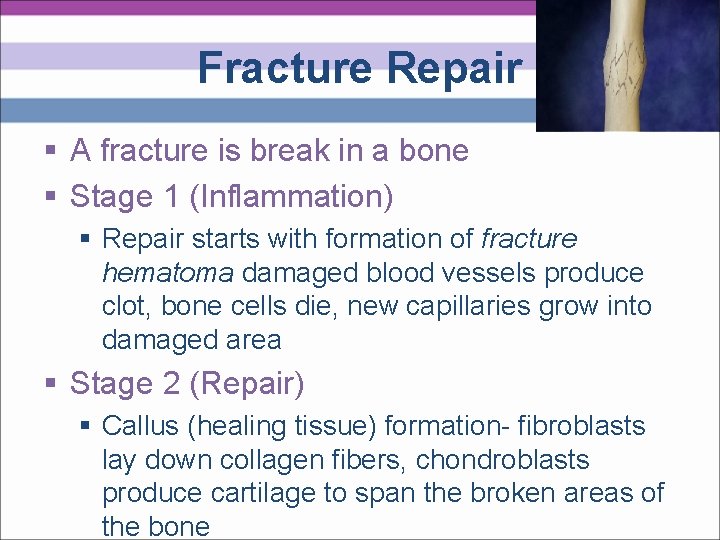 Fracture Repair § A fracture is break in a bone § Stage 1 (Inflammation)
