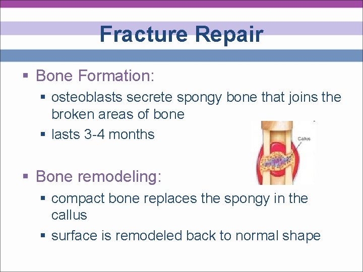 Fracture Repair § Bone Formation: § osteoblasts secrete spongy bone that joins the broken