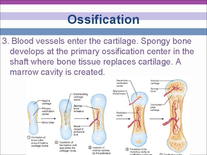 Ossification 3. Blood vessels enter the cartilage. Spongy bone develops at the primary ossification