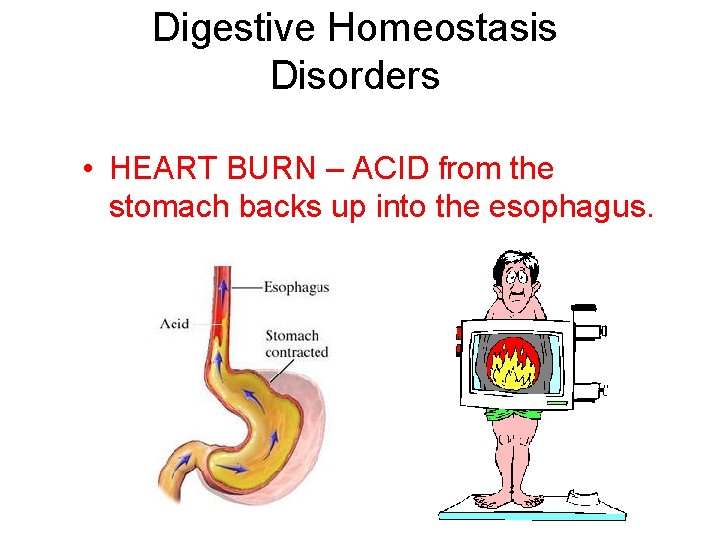 Digestive Homeostasis Disorders • HEART BURN – ACID from the stomach backs up into