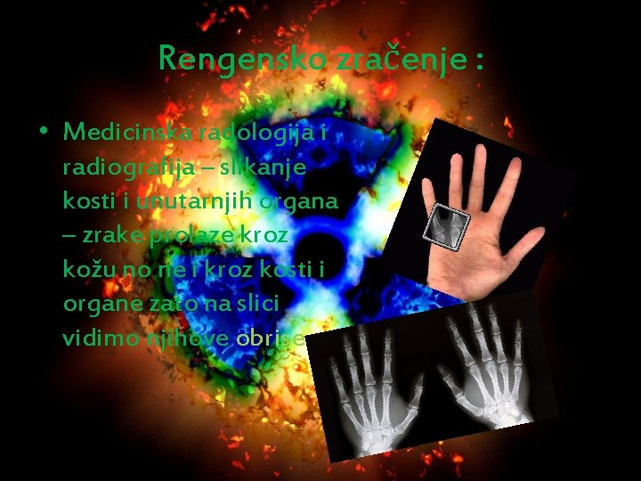Rengensko zračenje : • Medicinska radologija i radiografija – slikanje kosti i unutarnjih organa