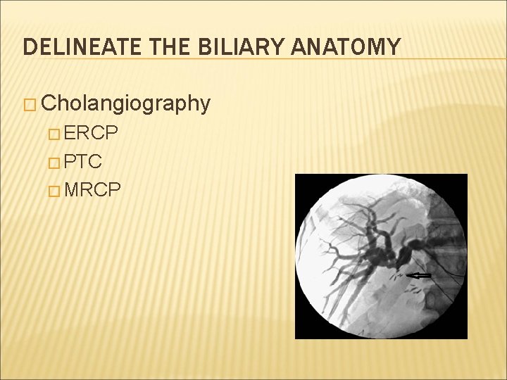 DELINEATE THE BILIARY ANATOMY � Cholangiography � ERCP � PTC � MRCP 