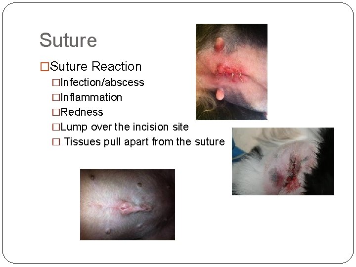 Suture �Suture Reaction �Infection/abscess �Inflammation �Redness �Lump over the incision site � Tissues pull