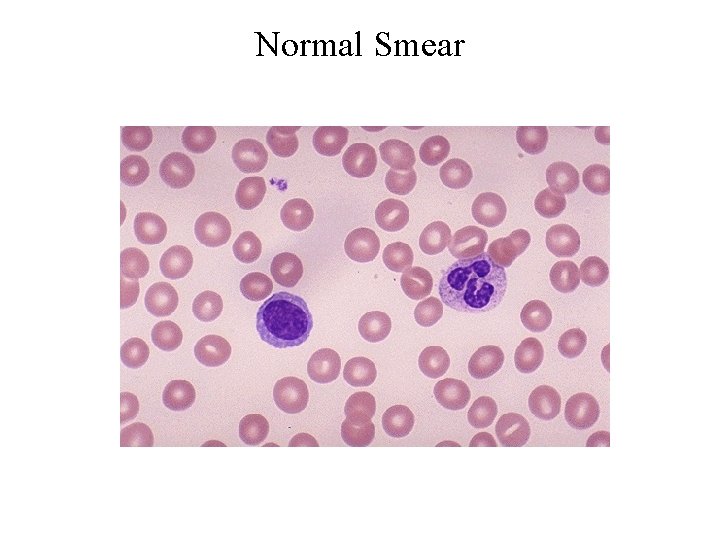 Normal Smear 