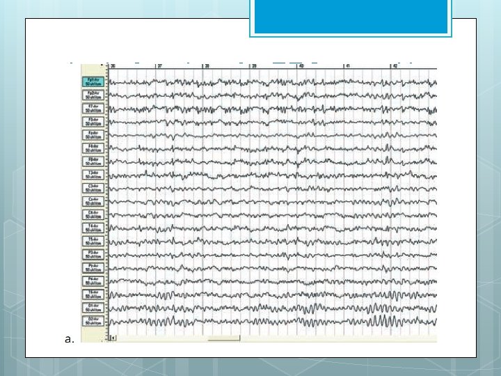 brain function. An EEG record is shown in 2. 11 a 