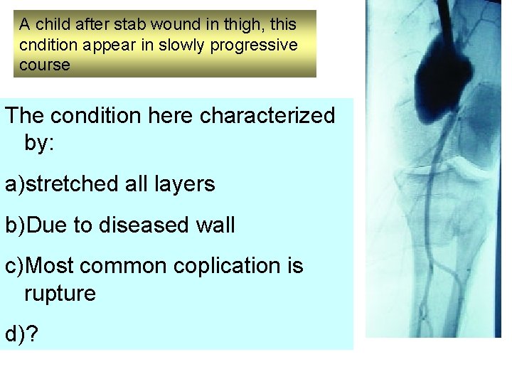 A child after stab wound in thigh, this cndition appear in slowly progressive course