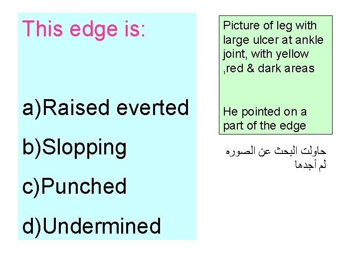 This edge is: a)Raised everted b)Slopping c)Punched d)Undermined Picture of leg with large ulcer