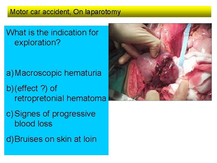 Motor car accident, On laparotomy What is the indication for exploration? a) Macroscopic hematuria