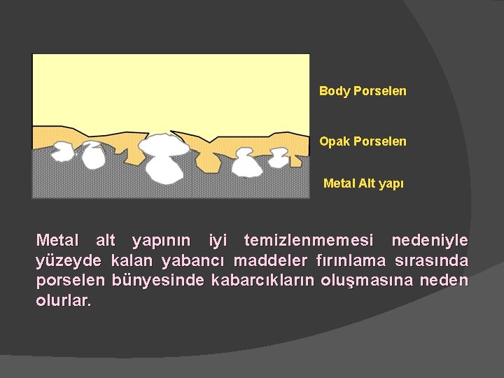 Body Porselen Opak Porselen Metal Alt yapı Metal alt yapının iyi temizlenmemesi nedeniyle yüzeyde