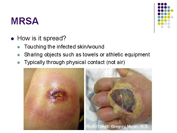 MRSA l How is it spread? l l l Touching the infected skin/wound Sharing