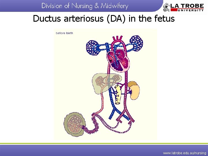 Ductus arteriosus (DA) in the fetus www. latrobe. edu. au/nursing 