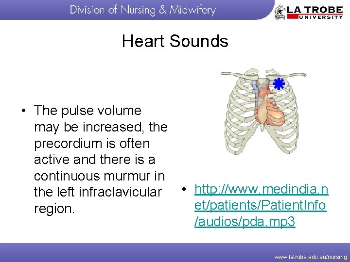 Heart Sounds • The pulse volume may be increased, the precordium is often active