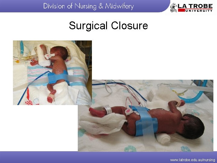 Surgical Closure www. latrobe. edu. au/nursing 