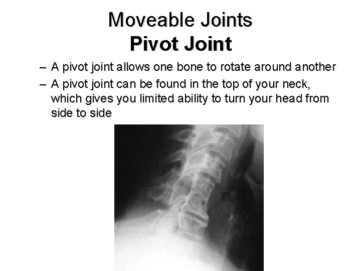 Moveable Joints Pivot Joint – A pivot joint allows one bone to rotate around