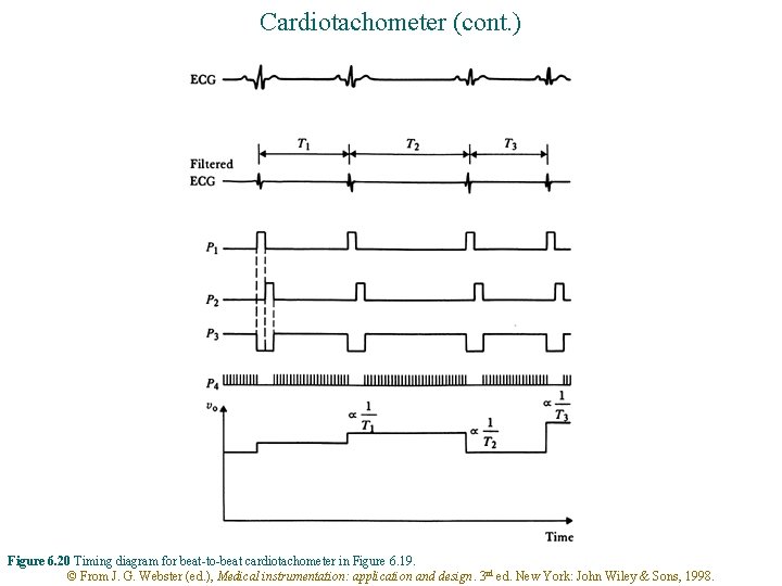 Cardiotachometer (cont. ) Figure 6. 20 Timing diagram for beat-to-beat cardiotachometer in Figure 6.