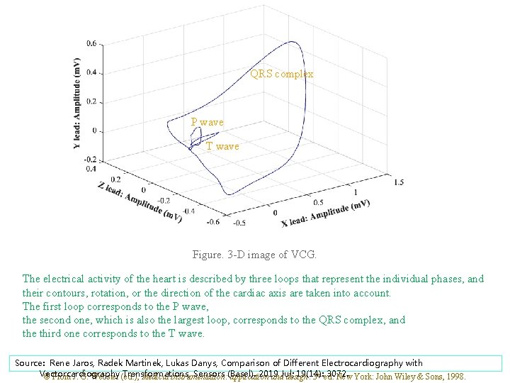 QRS complex P wave T wave Figure. 3 -D image of VCG. The electrical