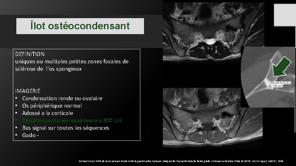 Îlot ostéocondensant DEFINITION uniques ou multiples petites zones focales de sclérose de l’os spongieux Îlot ostéocondensant DEFINITION uniques ou multiples petites zones focales de sclérose de l’os spongieux