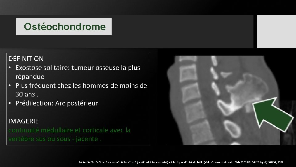 Ostéochondrome DÉFINITION • Exostose solitaire: tumeur osseuse la plus répandue • Plus fréquent chez Ostéochondrome DÉFINITION • Exostose solitaire: tumeur osseuse la plus répandue • Plus fréquent chez