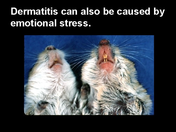 Dermatitis can also be caused by emotional stress. 