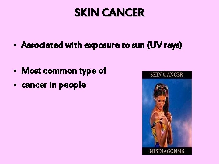 SKIN CANCER • Associated with exposure to sun (UV rays) • Most common type