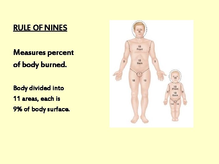 RULE OF NINES Measures percent of body burned. Body divided into 11 areas, each