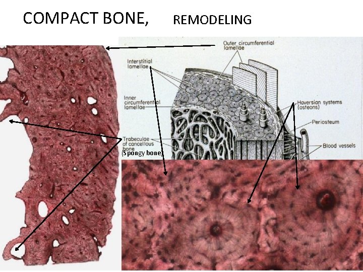 COMPACT BONE, (Spongy bone) REMODELING 