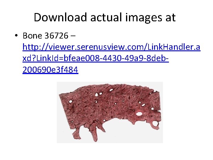 Download actual images at • Bone 36726 – http: //viewer. serenusview. com/Link. Handler. a Download actual images at • Bone 36726 – http: //viewer. serenusview. com/Link. Handler. a