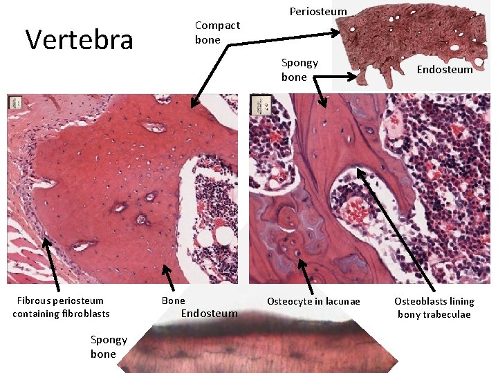 Compact bone Vertebra Fibrous periosteum containing fibroblasts Spongy bone Periosteum Spongy bone Bone Endosteum