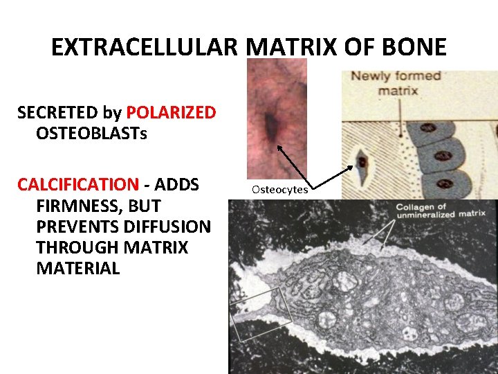 EXTRACELLULAR MATRIX OF BONE SECRETED by POLARIZED OSTEOBLASTs CALCIFICATION - ADDS FIRMNESS, BUT PREVENTS EXTRACELLULAR MATRIX OF BONE SECRETED by POLARIZED OSTEOBLASTs CALCIFICATION - ADDS FIRMNESS, BUT PREVENTS