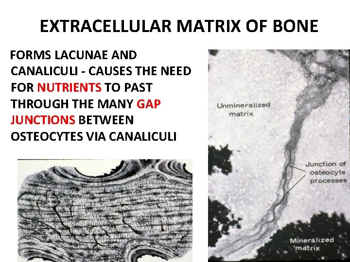 EXTRACELLULAR MATRIX OF BONE FORMS LACUNAE AND CANALICULI - CAUSES THE NEED FOR NUTRIENTS EXTRACELLULAR MATRIX OF BONE FORMS LACUNAE AND CANALICULI - CAUSES THE NEED FOR NUTRIENTS