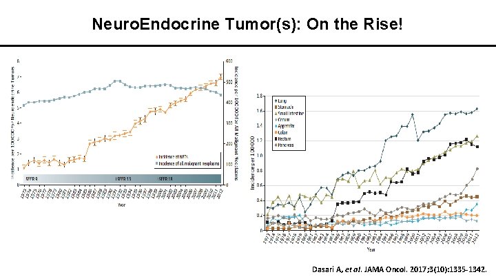 Neuro. Endocrine Tumor(s): On the Rise! Dasari A, et al. JAMA Oncol. 2017; 3(10):