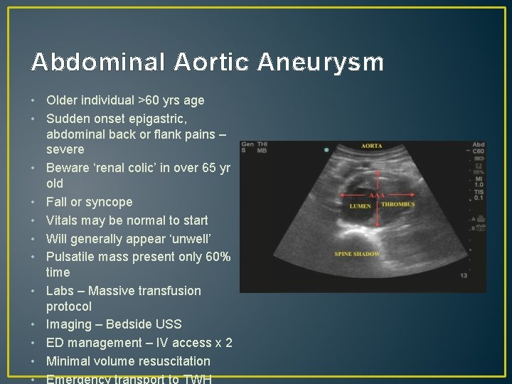 Abdominal Aortic Aneurysm • Older individual >60 yrs age • Sudden onset epigastric, abdominal