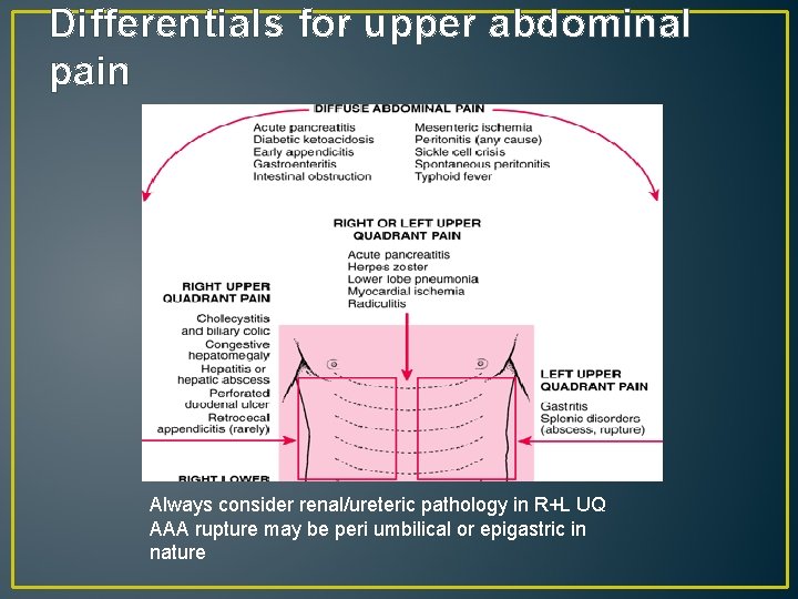 Differentials for upper abdominal pain Always consider renal/ureteric pathology in R+L UQ AAA rupture