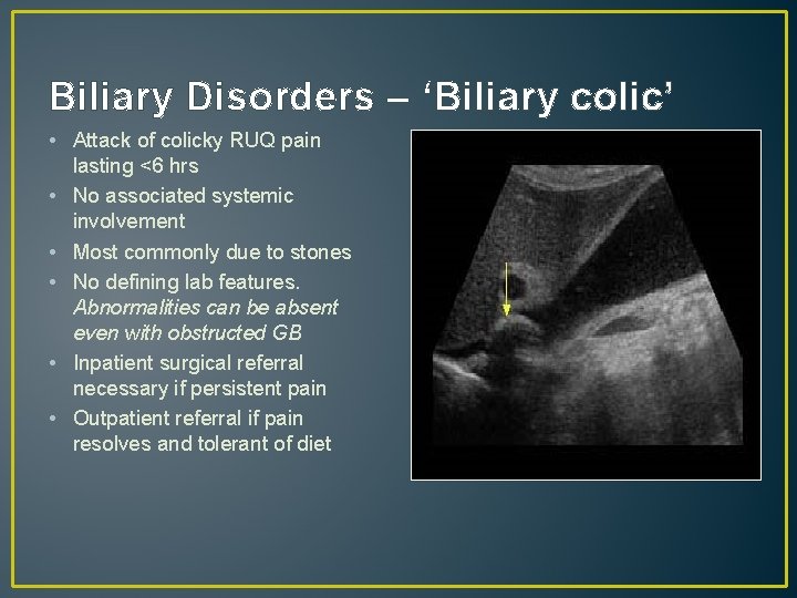 Biliary Disorders – ‘Biliary colic’ • Attack of colicky RUQ pain lasting <6 hrs