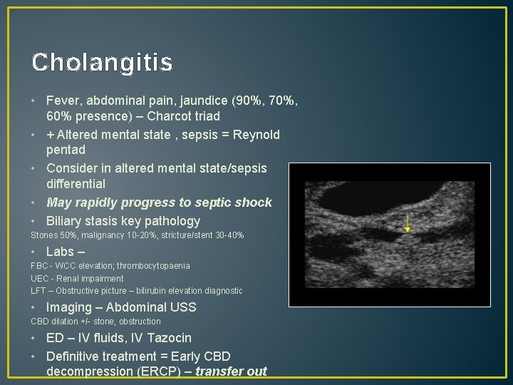Cholangitis • Fever, abdominal pain, jaundice (90%, 70%, 60% presence) – Charcot triad •