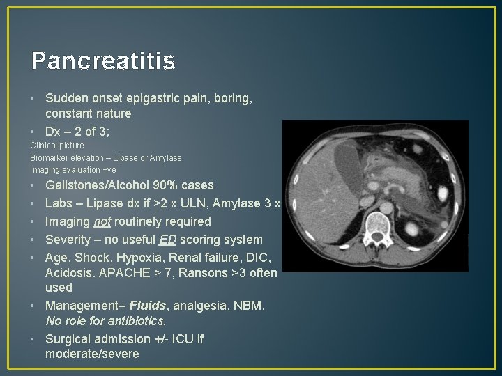 Pancreatitis • Sudden onset epigastric pain, boring, constant nature • Dx – 2 of
