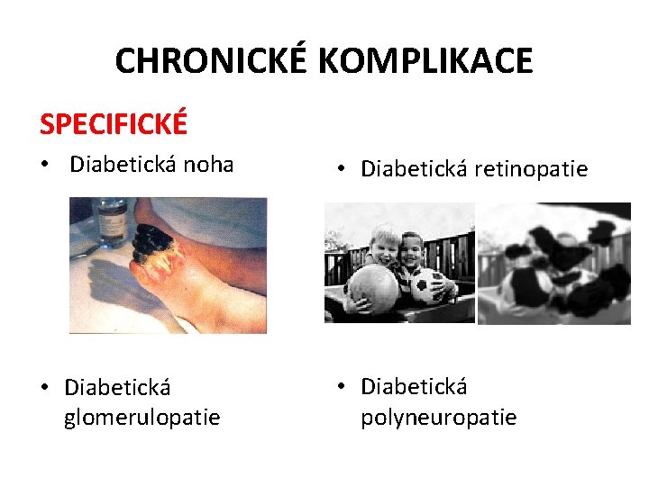 CHRONICKÉ KOMPLIKACE SPECIFICKÉ • Diabetická noha • Diabetická retinopatie • Diabetická glomerulopatie • Diabetická