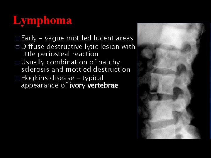 Lymphoma � Early - vague mottled lucent areas � Diffuse destructive lytic lesion with