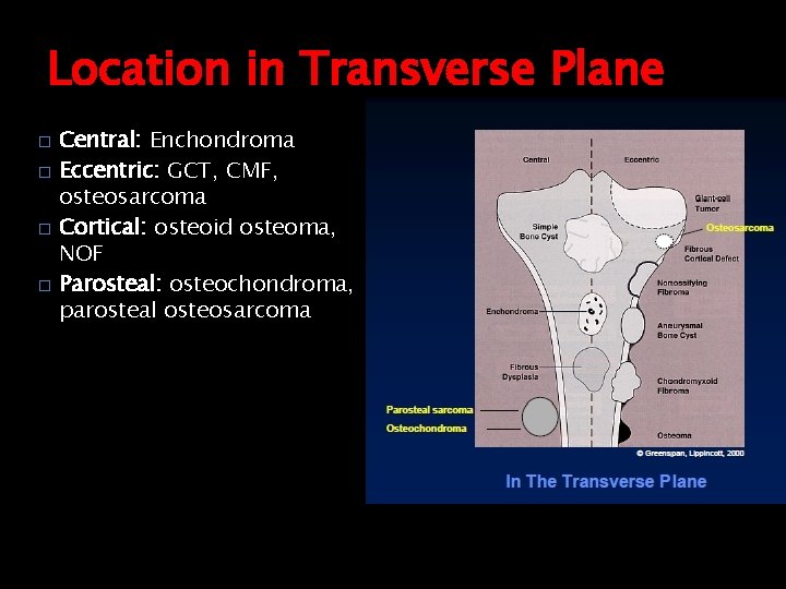 Location in Transverse Plane � � Central: Enchondroma Eccentric: GCT, CMF, osteosarcoma Cortical: osteoid