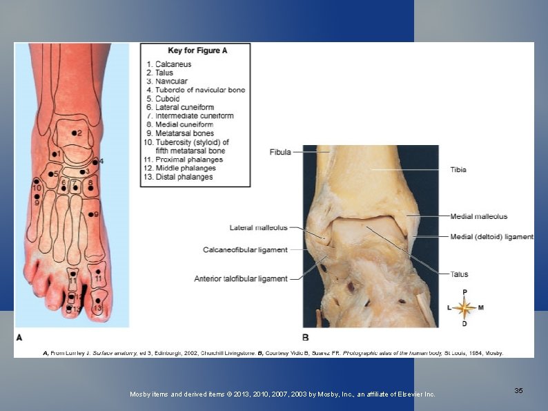 Mosby items and derived items © 2013, 2010, 2007, 2003 by Mosby, Inc. ,