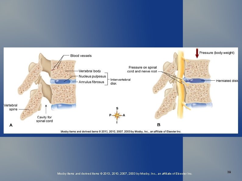 Mosby items and derived items © 2013, 2010, 2007, 2003 by Mosby, Inc. ,