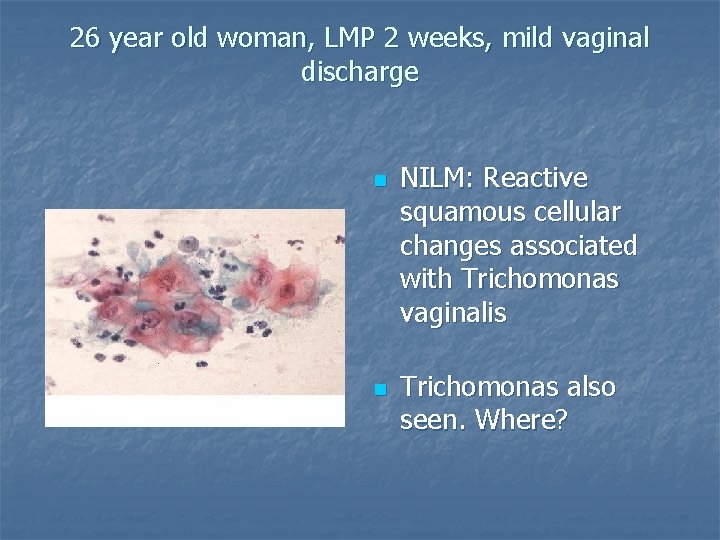 26 year old woman, LMP 2 weeks, mild vaginal discharge n n NILM: Reactive