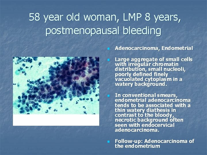 58 year old woman, LMP 8 years, postmenopausal bleeding n n Adenocarcinoma, Endometrial Large